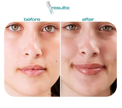 ✨BP Spicule Plumping Lip Shot