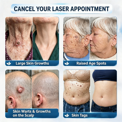 7-Day Skin Tag & Stain Remover