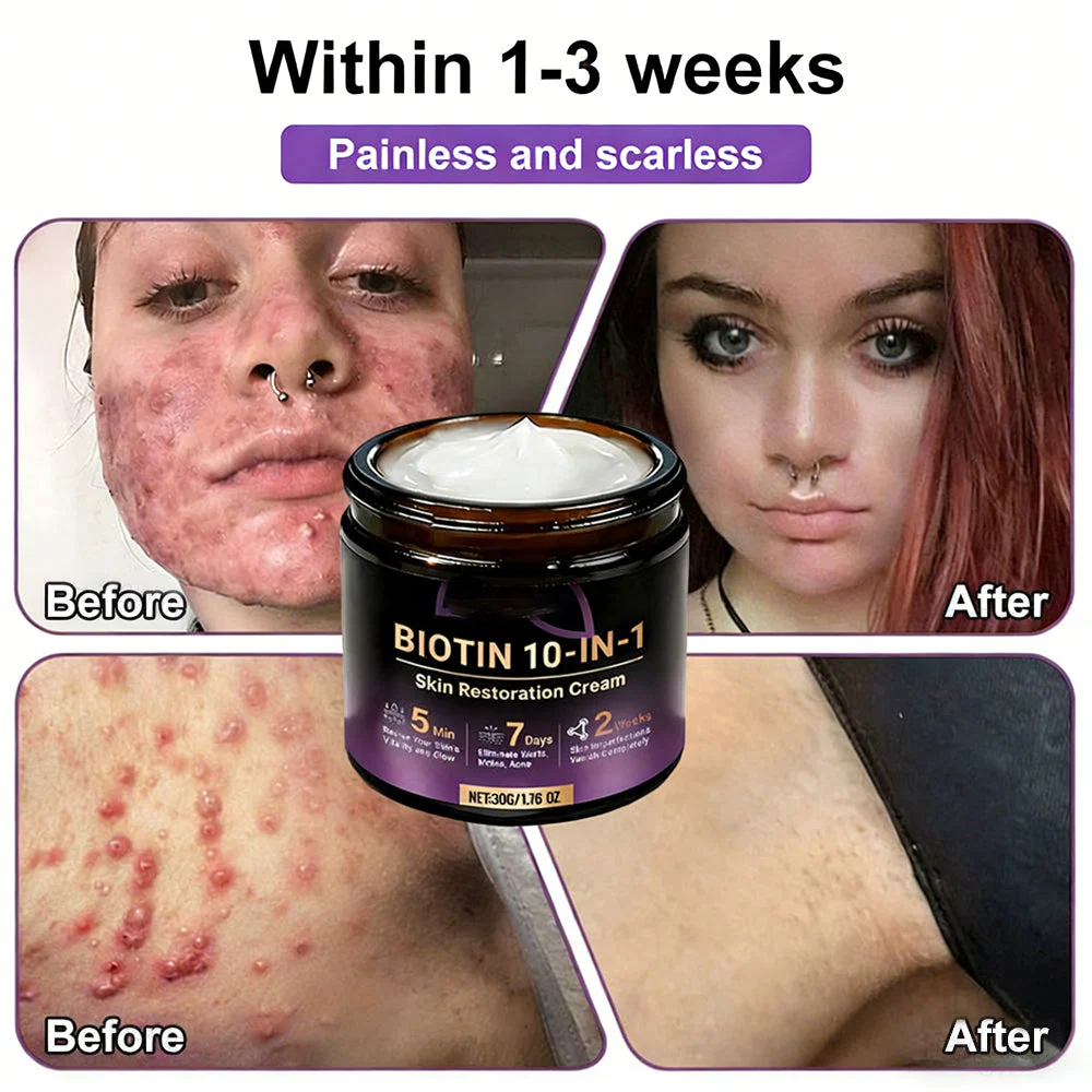 Biotin 10-in-1 Skin Restoration Cream