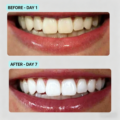 7-Day Glow Whitening Gel Pen