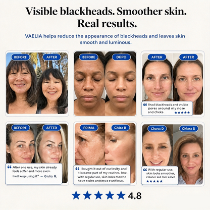 Zero Pore & Blackhead Mask