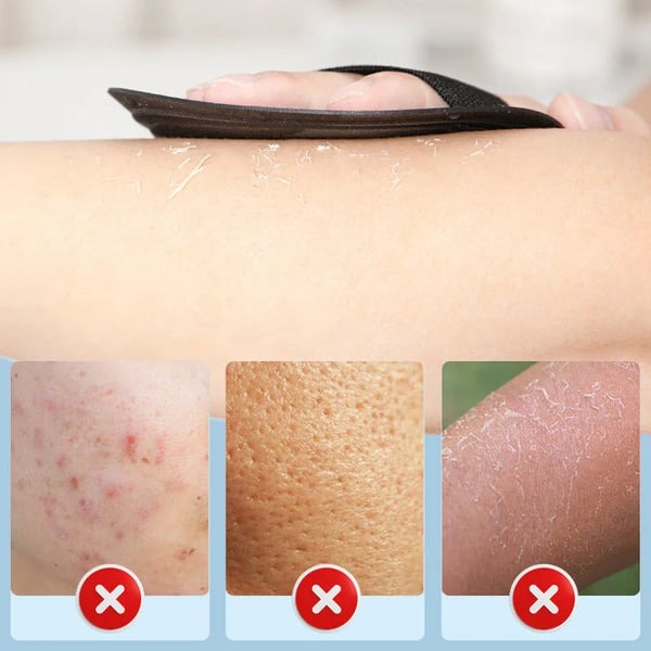 🧽Exfoliating Scrub Bath Pads — Deep Exfoliation, Reusable