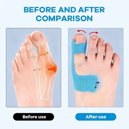 Pre-cut medical corrective tape