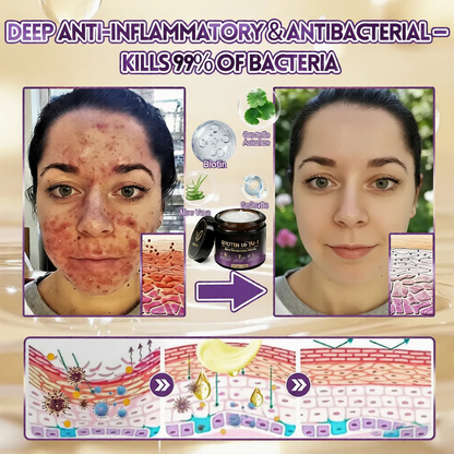Biotin 10-in-1 Skin Restoration Cream