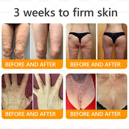 𝐀𝐏𝐊𝐀𝐏® 𝐁𝐞𝐞 𝐯𝐞𝐧𝐨𝐦 𝐒𝐤𝐢𝐧 𝐑𝐞𝐬𝐭𝐨𝐫𝐚𝐭𝐢𝐨𝐧 𝐂𝐫𝐞𝐚𝐦|𝐋𝐀𝐒𝐓 𝐃𝐀𝐘 𝟖𝟎% 𝐎𝐅𝐅💎💎 𝑃𝑜𝑤𝑒𝑟𝑓𝑢𝑙 𝑎𝑛𝑡𝑖-𝑎𝑔𝑖𝑛𝑔 𝑠𝑜𝑙𝑢𝑡𝑖𝑜𝑛 𝑡ℎ𝑎𝑡 𝑡𝑎𝑟𝑔𝑒𝑡𝑠 𝑑𝑒𝑒𝑝 𝑤𝑟𝑖𝑛𝑘𝑙𝑒𝑠, 𝑓𝑖𝑛𝑒 𝑙𝑖𝑛𝑒𝑠, 𝑠𝑎𝑔𝑔𝑖𝑛𝑔 𝑠𝑘𝑖𝑛, 𝑎𝑛𝑑 𝑑𝑟𝑦𝑛𝑒𝑠𝑠