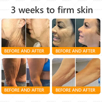 𝐀𝐏𝐊𝐀𝐏® 𝐁𝐞𝐞 𝐯𝐞𝐧𝐨𝐦 𝐒𝐤𝐢𝐧 𝐑𝐞𝐬𝐭𝐨𝐫𝐚𝐭𝐢𝐨𝐧 𝐂𝐫𝐞𝐚𝐦|𝐋𝐀𝐒𝐓 𝐃𝐀𝐘 𝟖𝟎% 𝐎𝐅𝐅💎💎 𝑃𝑜𝑤𝑒𝑟𝑓𝑢𝑙 𝑎𝑛𝑡𝑖-𝑎𝑔𝑖𝑛𝑔 𝑠𝑜𝑙𝑢𝑡𝑖𝑜𝑛 𝑡ℎ𝑎𝑡 𝑡𝑎𝑟𝑔𝑒𝑡𝑠 𝑑𝑒𝑒𝑝 𝑤𝑟𝑖𝑛𝑘𝑙𝑒𝑠, 𝑓𝑖𝑛𝑒 𝑙𝑖𝑛𝑒𝑠, 𝑠𝑎𝑔𝑔𝑖𝑛𝑔 𝑠𝑘𝑖𝑛, 𝑎𝑛𝑑 𝑑𝑟𝑦𝑛𝑒𝑠𝑠
