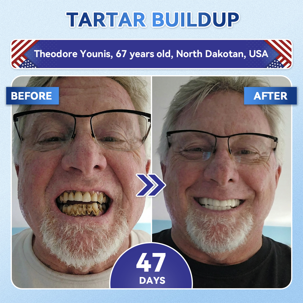 Tideglusib Tooth & Gum Repair Fast‑Dissolving Oral Strips