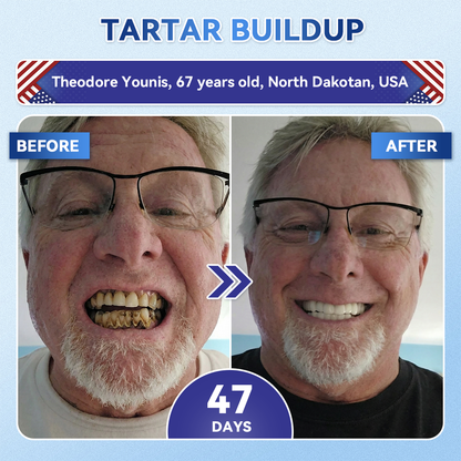Tideglusib Tooth & Gum Repair Fast‑Dissolving Oral Strips