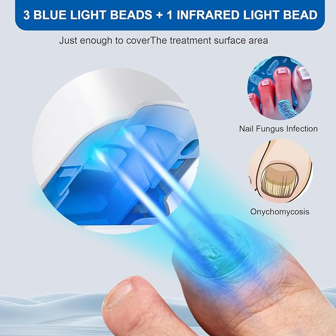 Rapid Clear Nail Fungus Laser Device: Eliminate Stubborn Onychomycosis Fast