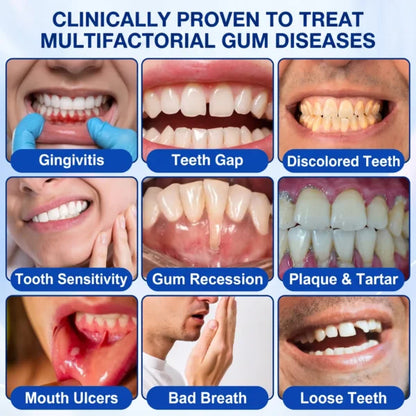  Periodontal Repair Gel