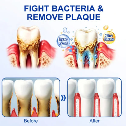  Periodontal Repair Gel