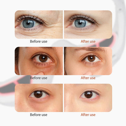 Eye Massager With Red Light For Under Eye Swelling And Fine Lines