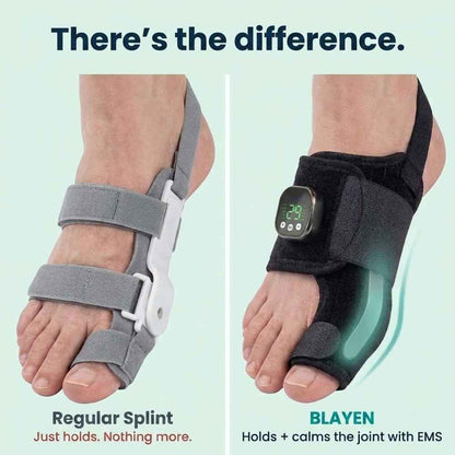 EMS Bunion Corrector, Electric Foot Massager for Hallux Valgus Relief