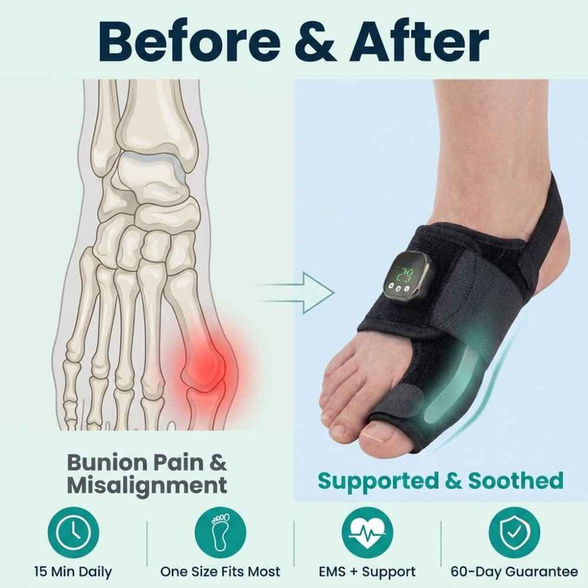 EMS Bunion Corrector, Electric Foot Massager for Hallux Valgus Relief