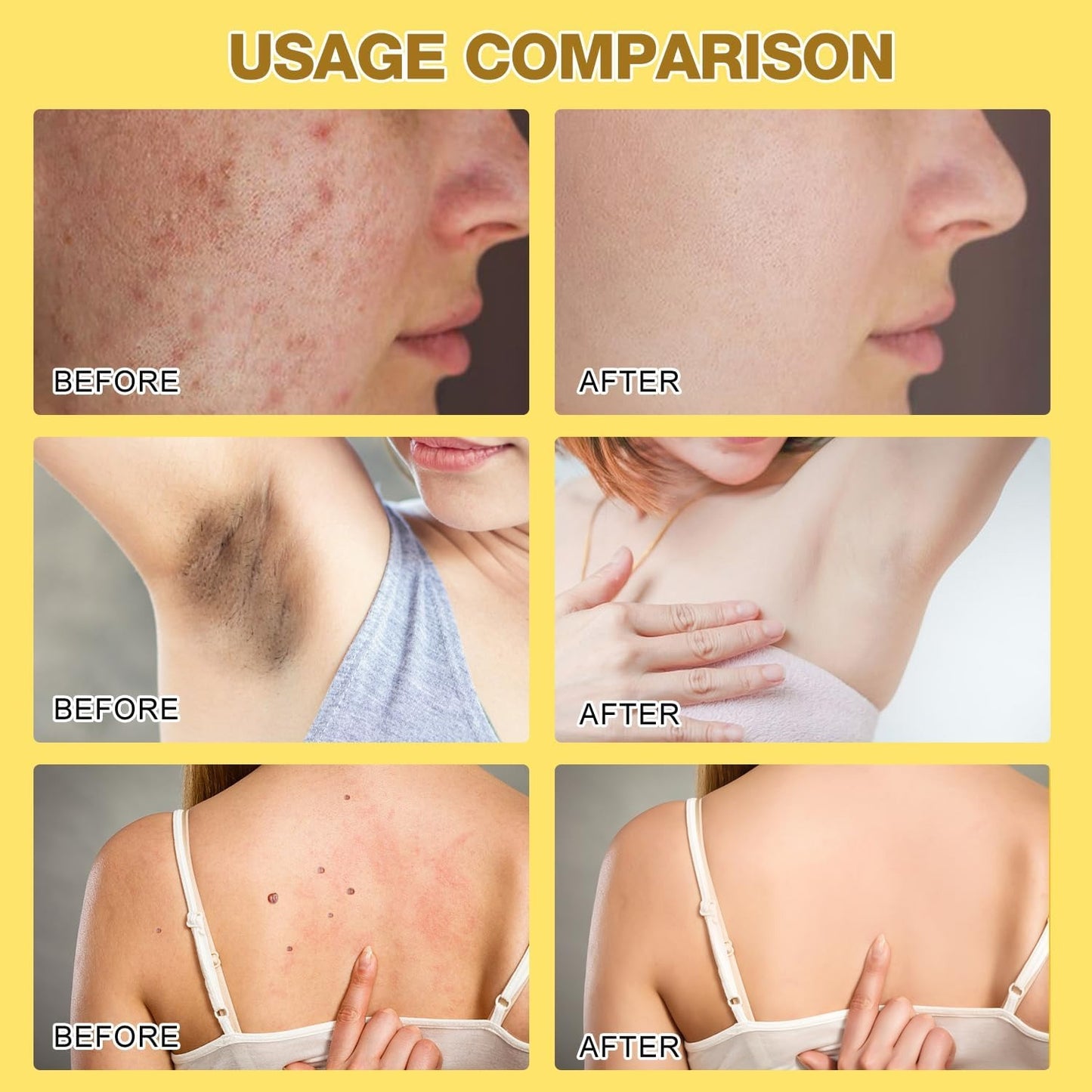 𝐋𝐀𝐒𝐓 𝐃𝐀𝐘 𝟖𝟎% 𝐎𝐅𝐅💎💎 Bee Venom Firm & Revive Cream