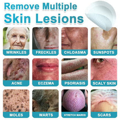 🌿2-in-1 Microneedle & Hydrocolloid Patch👨‍⚕️ | Removes raised moles, acne, flat warts, and skin tags