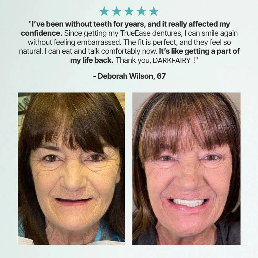 Custom-Fit Dentures — Designed for Comfort and a Natural-Looking Smile