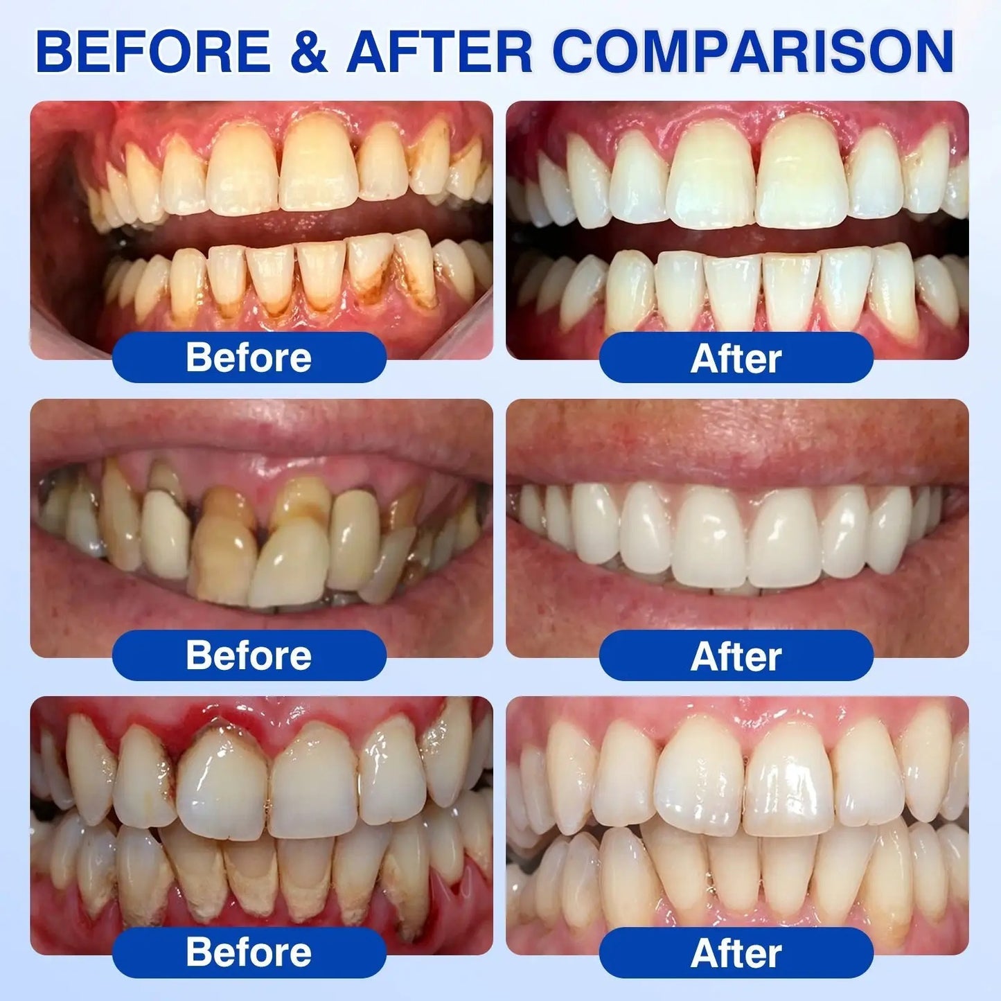  Periodontal Repair Gel