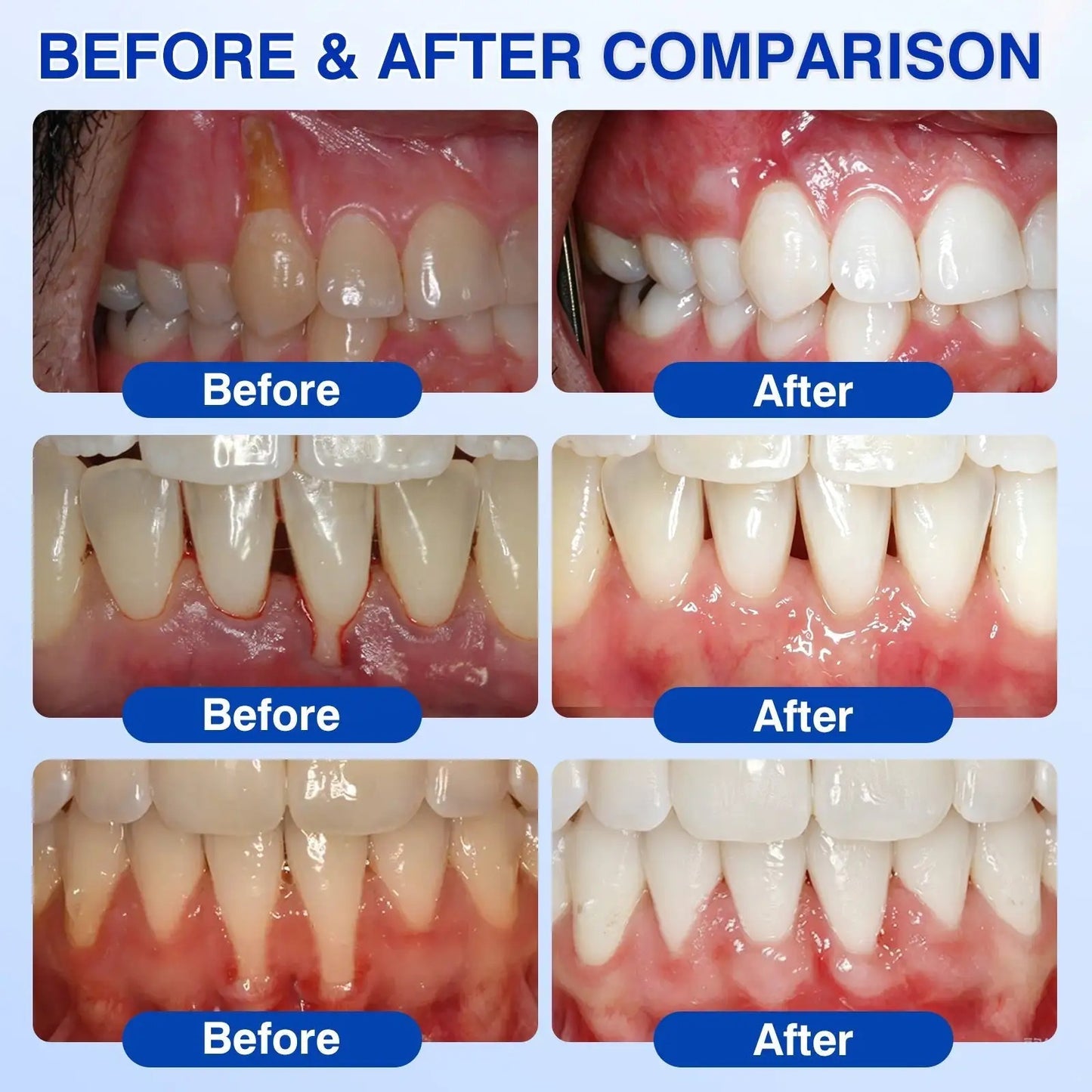  Periodontal Repair Gel