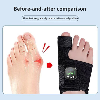 EMS Bunion Corrector, Electric Foot Massager for Hallux Valgus Relief