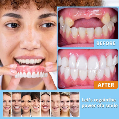 Custom-Fit Dentures — Designed for Comfort and a Natural-Looking Smile