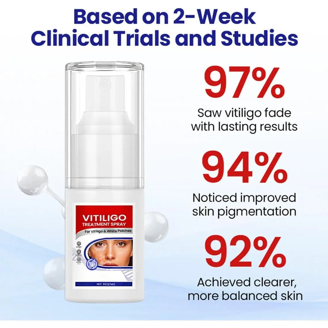 Vitiligo Treatment Spray-Professional White Spot Remover