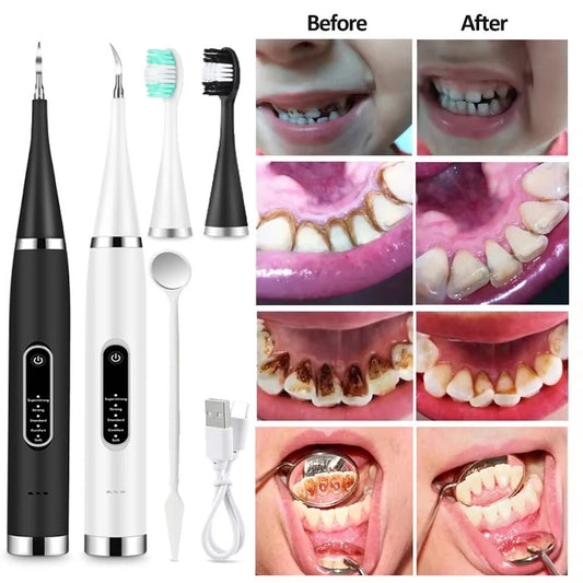 Electric Ultrasonic Dental Scaler –Teeth Cleaner & Tartar Remover Tool