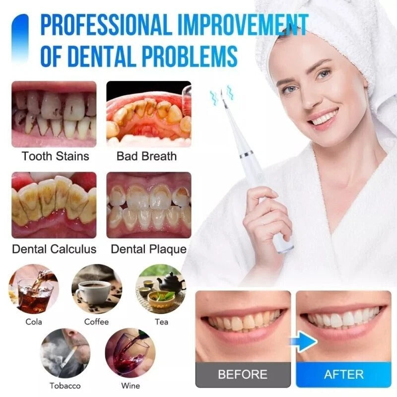 Electric Ultrasonic Dental Scaler –Teeth Cleaner & Tartar Remover Tool