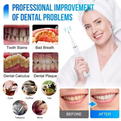 Electric Ultrasonic Dental Scaler –Teeth Cleaner & Tartar Remover Tool