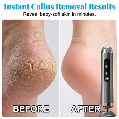 Multi-Function Electric Foot Grinder with 5 Speeds