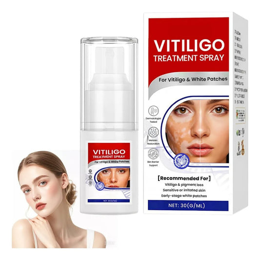 Vitiligo Treatment Spray-Professional White Spot Remover